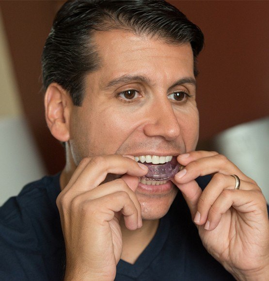 Man placing oral appliance for sleep apnea therapy