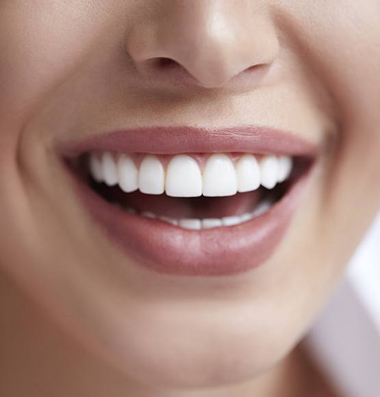 Closeup of smile after gum recontouring