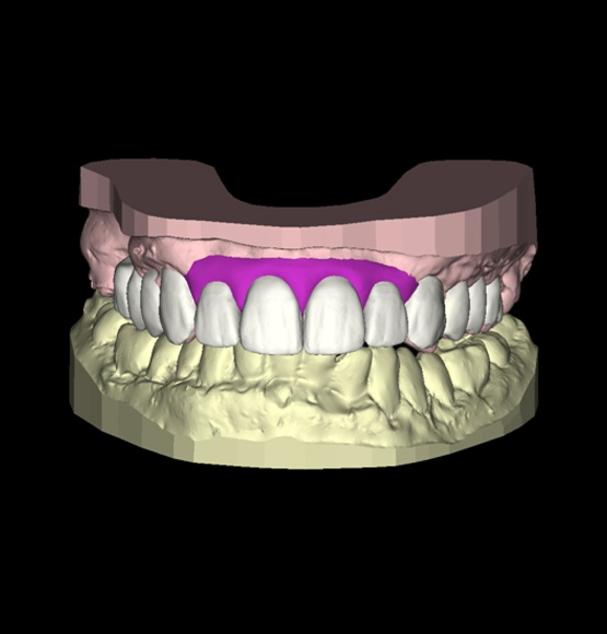 Virtual smile design for cosmetic dentistry transformation