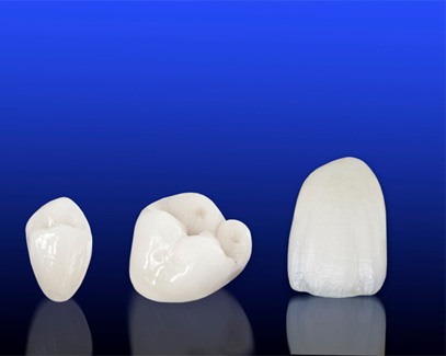 Three dental crowns in Tucson, AZ standing in a row 