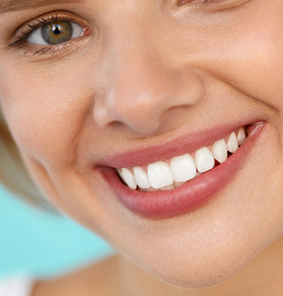 closeup of woman smiling after getting dental crown 