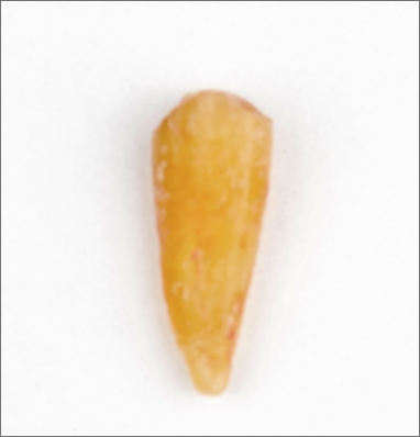 Extracted tooth prepared for dentin grafting