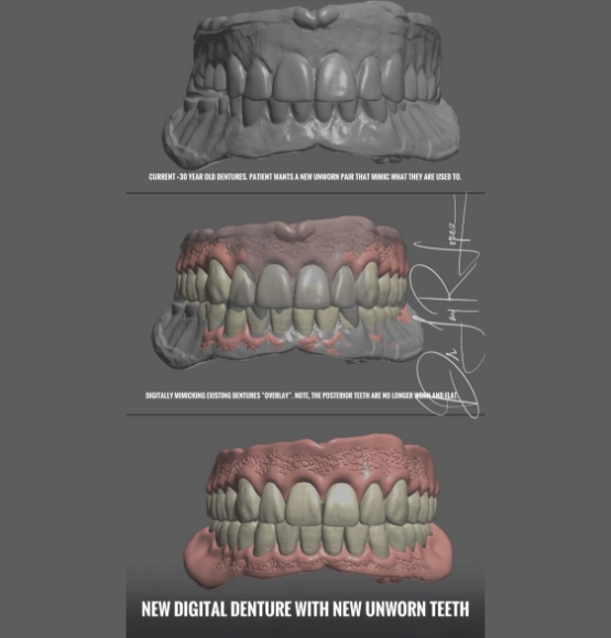 digital dentures being made in lab 