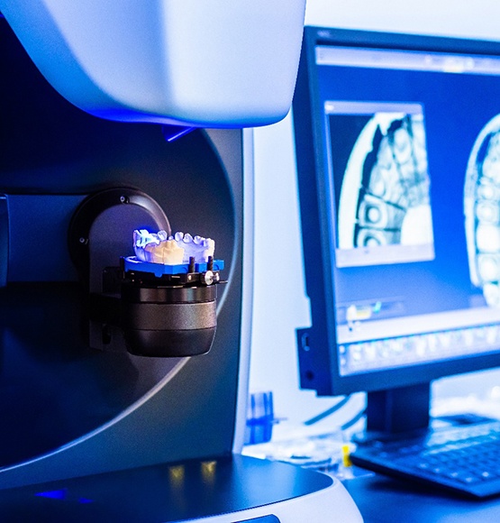 digital dentures being made in lab 