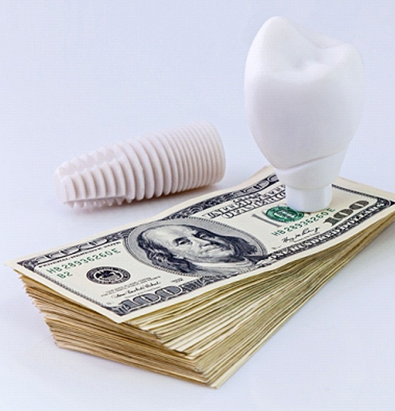 Implant on money representing the cost of dental implant sin Tucson