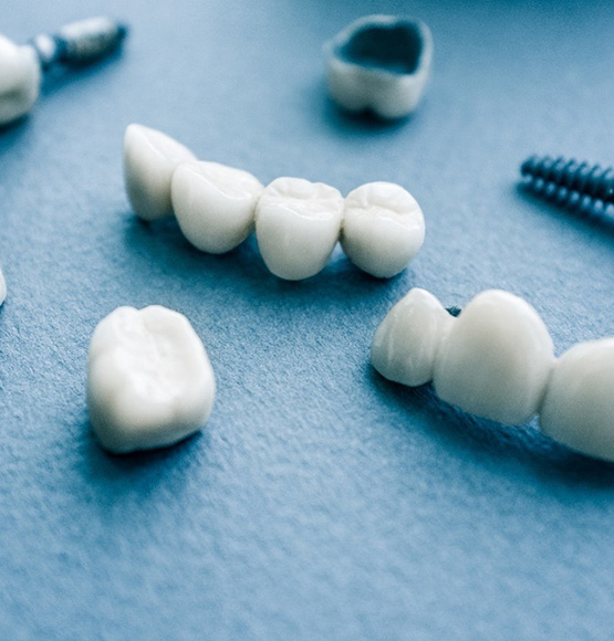Different types of dental implants in Tucson on blue background