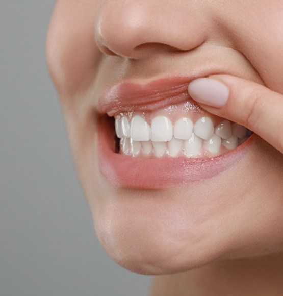 Woman lifting her lip to show healthy gums