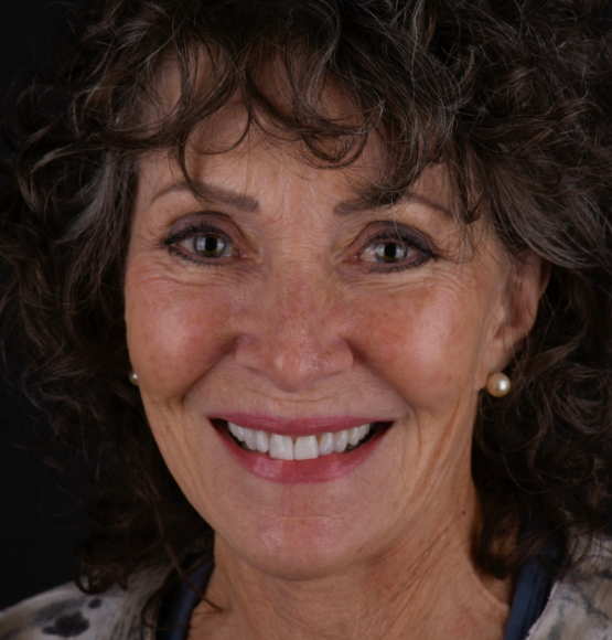 Patient smiling after procedures by Dr. Lopez