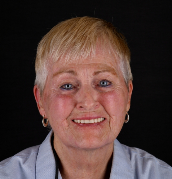 Patient smiling after procedures by Dr. Lopez