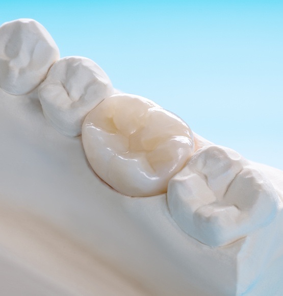 Model smile with dental crown restorative dentistry solution
