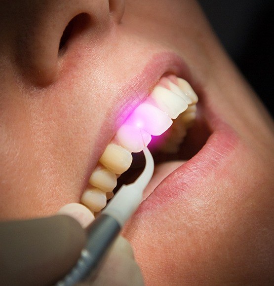 Patient receiving soft tissue laser dentistry treatment
