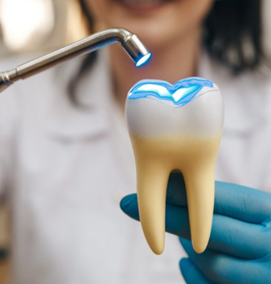 Tucson dentist showing composite filling treatment on model 
